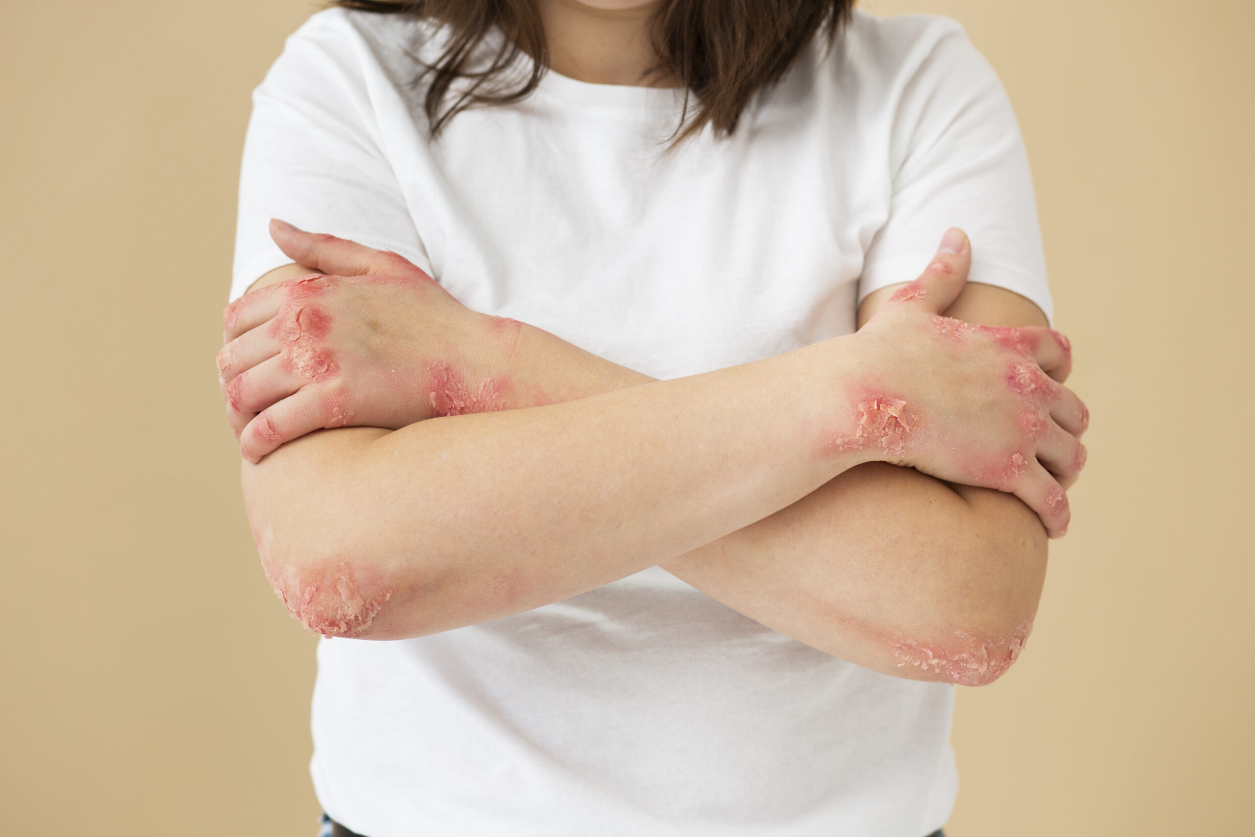 Can Smoking and Alcohol Make Skin Problems Worse?